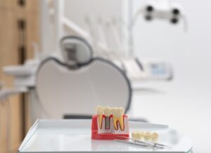 dental implants clinton township